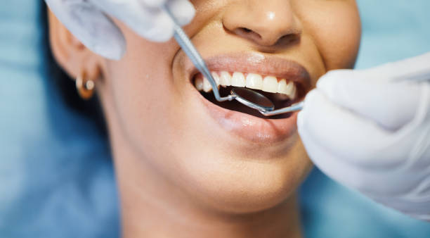 Best Emergency Tooth Extraction in Penitas, TX
