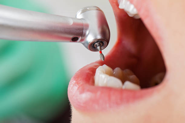 Best Emergency Dental Care for Broken or Chipped Teeth in Penitas, TX